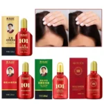 Hair Tonic Zhangguang 101B Powerful Chinese Medicine Therapy Anti Hair Loss Strengthen Hair Roots Treatment Essence