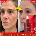 Firming Serum Face Neck Wrinkle Remover Red Essence EGF NAD Collagen Anti-Aging Reduce Fine Lines  Increase Skin Elasticity 30ml